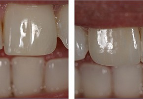 «Денталика», стоматология фото 12