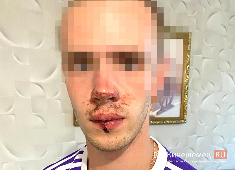 В Кинешме замдиректора ДК «Октябрь» прямо у клуба жестоко избил 19-летнего студента