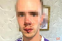 В Кинешме замдиректора ДК «Октябрь» прямо у клуба жестоко избил 19-летнего студента