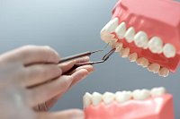 Съемные зубные протезы: плюсы, минусы и альтернативы