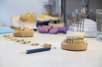 Изготовление циркониевых коронок в Кинешме