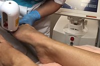 Как замедлить старение кожи после 30 лет?