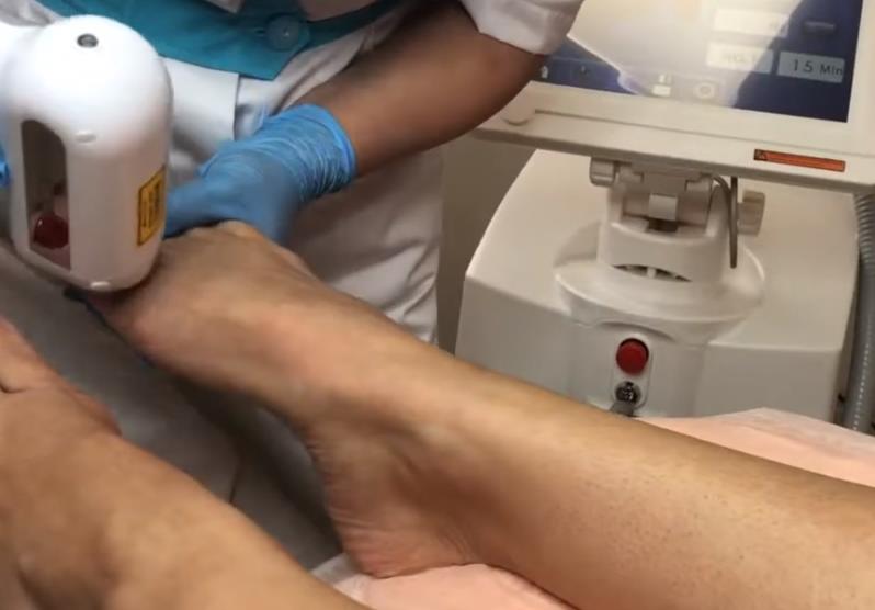 Как замедлить старение кожи после 30 лет?