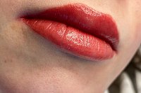 Как вернуть молодость коже?