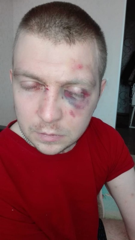 В Кинешме инвалида-десантника избили и выставили из дома фото 2