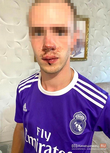В Кинешме замдиректора ДК «Октябрь» прямо у клуба жестоко избил 19-летнего студента фото 2