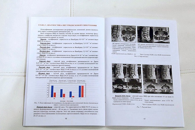 Кинешемские нейрохирурги внедряют новую методику лечения болей в спине фото 5