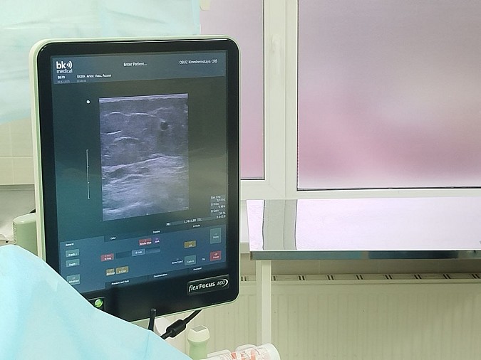 В Кинешемской ЦРБ выполняются операции при варикозной болезни вен на ногах фото 3